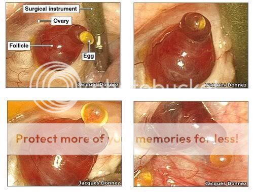 A Graphic Picture Of Ovulation Amazing Bump It BabyCentre